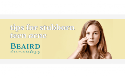 Tips for Stubborn Teen Acne