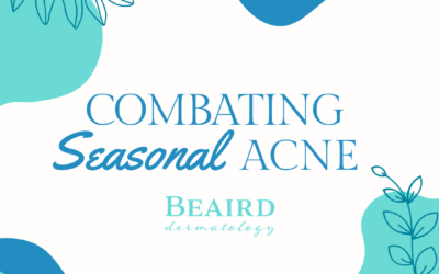 Combating Seasonal Acne: Tips for Clearing Up Breakouts in the Warmer Weather
